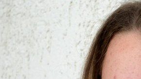¿Cuánta relación existe entre lo que comes y el estado de tu piel?
