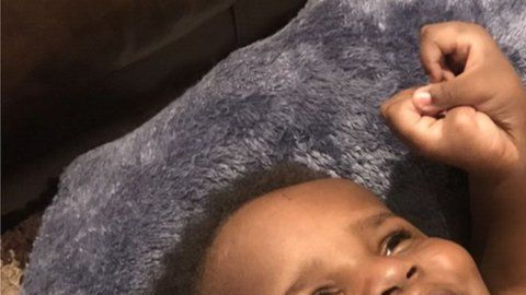 Ibrahima solo supo que era padre de siamesas tras el parto.