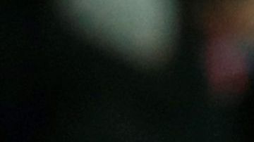 Neymar se resintió de la lesión de 2018 en el quinto metatarso del pie derecho.