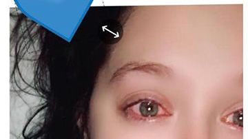 Solo quería trenzarse en el pelo a pesar de estar en el hospital.