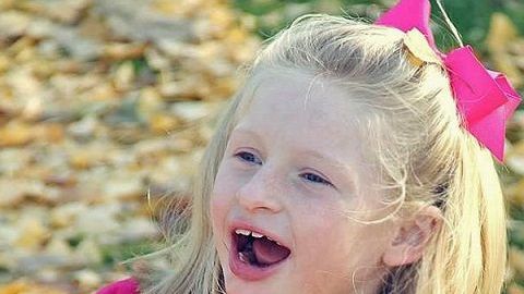 síndrome-de-angelman-1