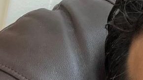 Jorge Viera con el rostro desfigurado por la infección.