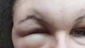 El rostro de la joven quedó deforme.