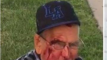 El anciano mexicano que reside legalmente en EE.UU. quedó tendido en la acera con heridas en el rostro y varias costillas rotas.