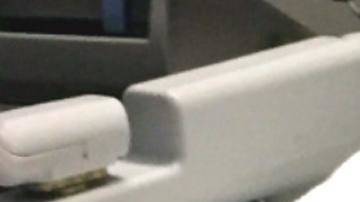 Niño con una malformación se somete a una cirugía labial.