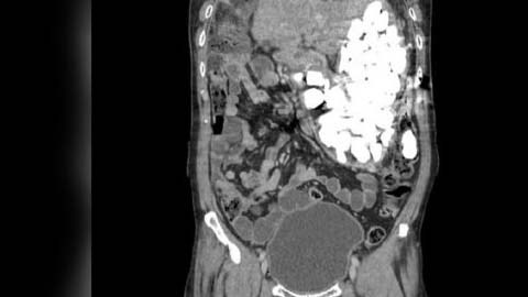 El asiático tuvo que ser intervenido qirúrgicamente.