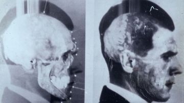 Científicos superpusieron las imágenes para confirmar la muerte de Mengele.