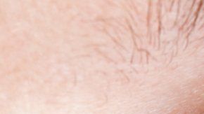 La disputa es por un medicamento para tratar los ojos resecos.