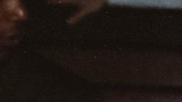 Patrick Burleigh empezó a lidiar con los efectos de la pubertad cuando tenía dos años.