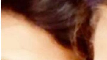 El antes y el después de esta mujer que fue torturada por su marido.