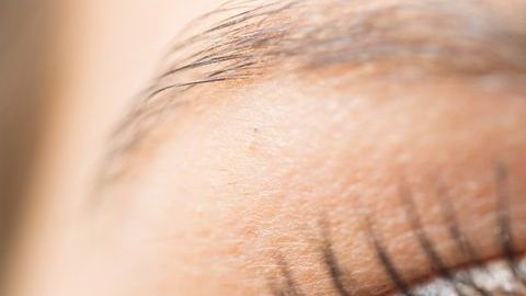 conjuntivitis1