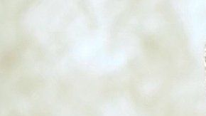 Un hombre se opera los genitales debido a su excesivo tamaño.