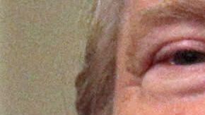 Esposo de Kellyane Conway asegura que Trump sufre trastornos mentales