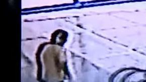 La joven sufrió varias y fuertes heridas en el rostro.