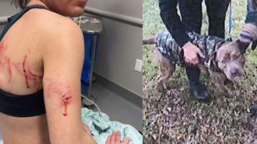 Las heridas de Caitlin Keen por el ataque de Taco.