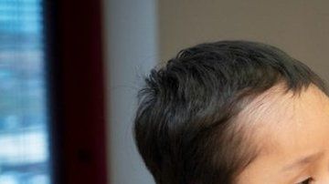 Gael fue uno de los niños que se benefició de este tratamiento.