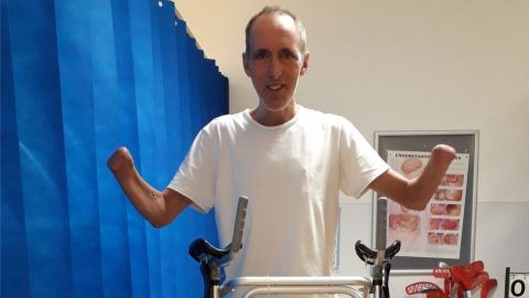 Mike Davies dijo haber aceptado que sus manos y piernas "tenían que desaparecer".