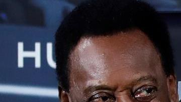 Pelé tuvo que ser hospitalizado en París