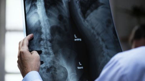anatomy-3003099_1920