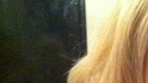 Hornby sufre de macromastía o gigantomastia juvenil.