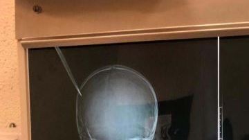 Las radiografías tomadas al menor herido.