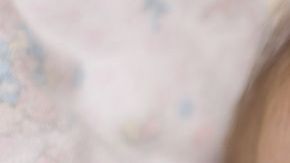 dermatitis-en-bebc3a9s