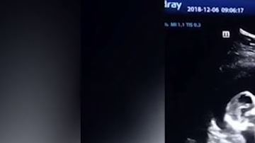 Las gemelas parecieran darse unos cuantos golpes.