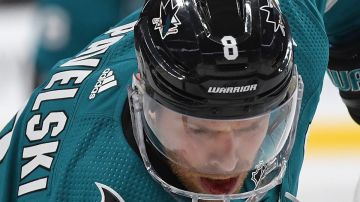 El capitán de los San Jose Sharks Joe Pavelski muestra las huellas del golpazo en la boca en el juego contra Las Vegas en los playoffs de la NHL.