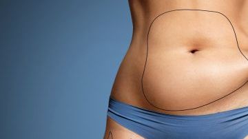 lipo-1