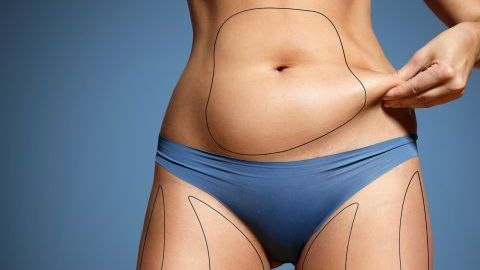 lipo-1