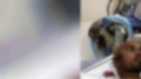 El hombre llegó consciente al hospital.