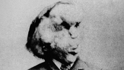 106786544_elephant_man