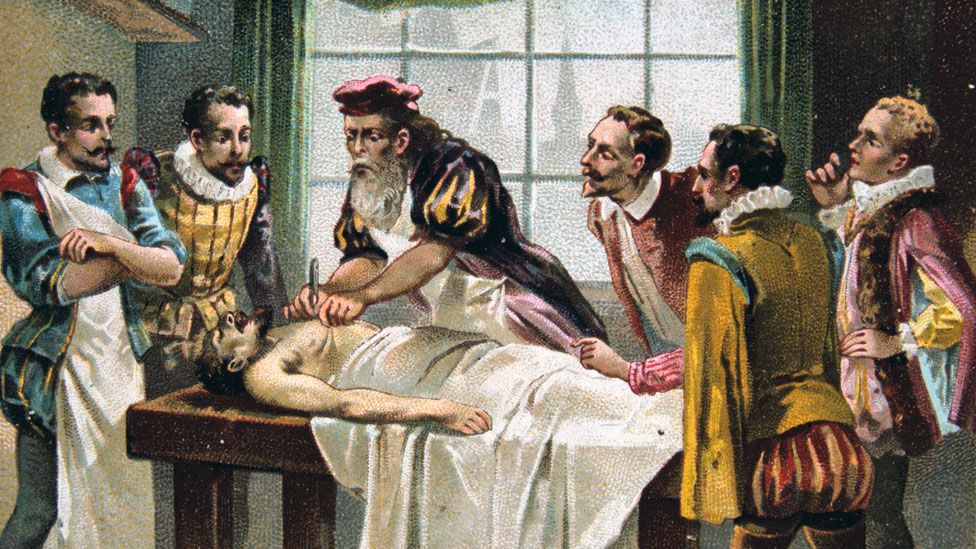 Врач 17 век. Амбруаз паре выдающийся хирург эпохи Возрождения. Хирург Амбруаз паре.