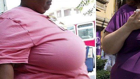 Las consecuencias de la obesidad son enfermedades.