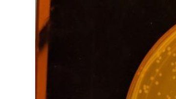 Es una versión artificial de la bacteria E. coli.