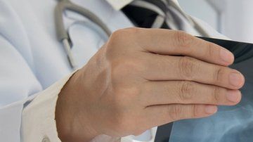 La inteligencia artificial podría aumentar la detección de cáncer .