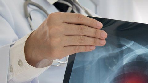 La inteligencia artificial podría aumentar la detección de cáncer .