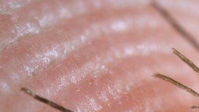 107168597_c0093034-feeding_mosquito-spl