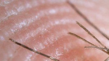 107168597_c0093034-feeding_mosquito-spl