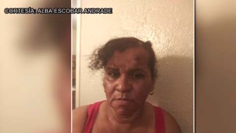 “Me agredieron muy feo, es algo que no quisiera volver a vivir...", dijo Escobar Andrade.