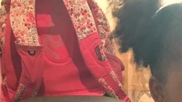 Loanny padede del Síndrome Nefrótico.