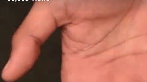 La mano herida de García