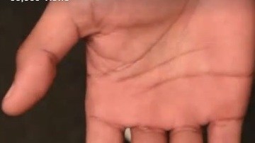 La mano herida de García