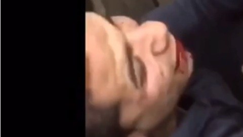 La víctima con el rostro herido