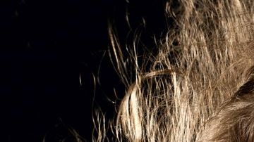 Cuando el problema es mayor o si sencillamente deseas eliminarlo desde los inicios, puedes seleccionar uno de los muchos tratamientos que actualmente existen.