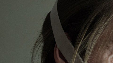 Vicky Knight odió sus cicatrices desde que era niña.