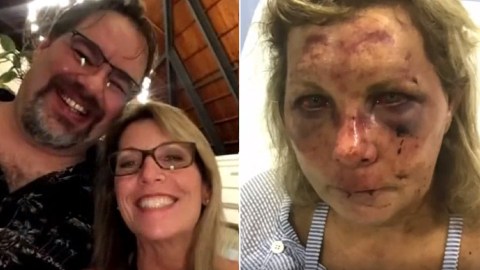 Los Daley estuvieron de vacaciones en República Dominicana, donde ella acusó que fue golpeada.