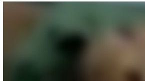 Los médicos aseguran que este hombre sobrevivió de milagro.