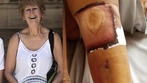 Lynn Flemming sufrió un corte.