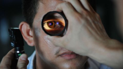 optometrist-91751_1280